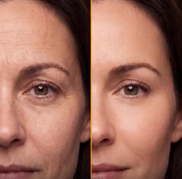 Botox & Aesthetic Treatments